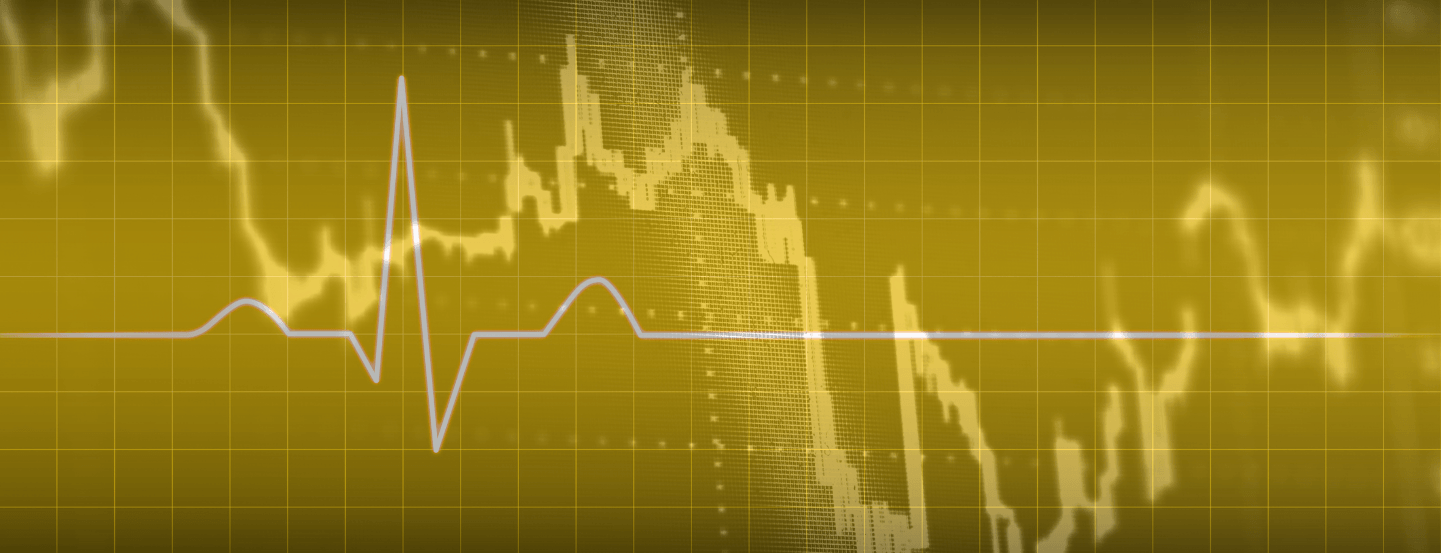 EKG line flatlining on top of a stock ticker graph, all in a gold hue.